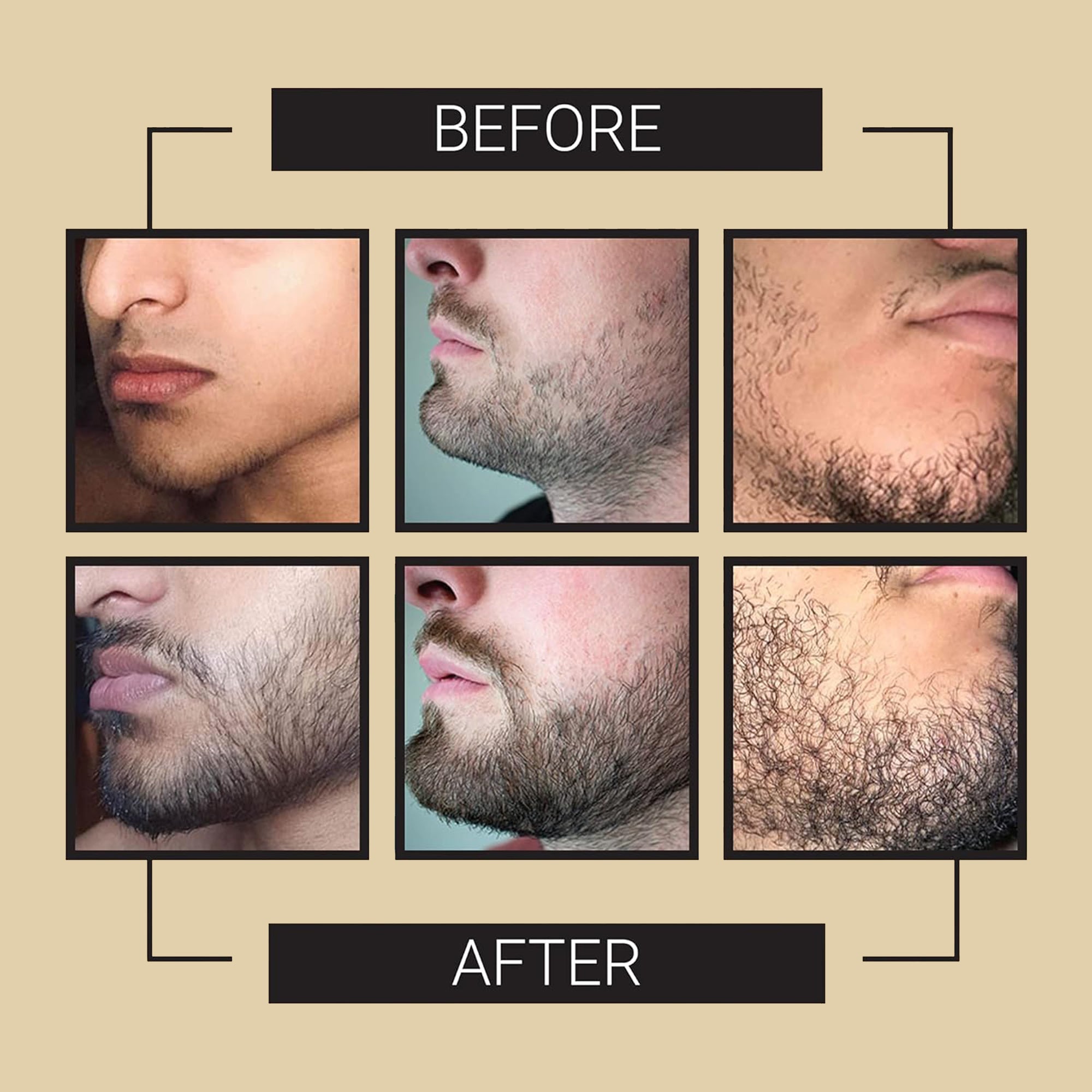 Beard Growth Kit - Grow A Thicker Fuller Beard - Beard Growth Serum - Beard Roller